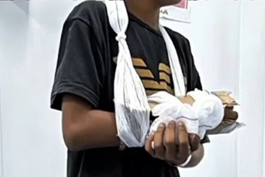 Braço de criança é imobilizado com papelão durante atendimento na UPA de São Pedro da Aldeia, na Região dos Lagos do Rio, que não contava com ortopedista nem material para engessamento -  (crédito: Reprodução/Redes Sociais)