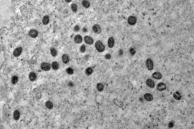 V&iacute;rus da mpox em imagem de microscopia eletr&ocirc;nica, doen&ccedil;a que j&aacute; registrou 17 casos em Minas Gerais, segundo a SES-MG. -  (crédito: D&eacute;bora F. Barreto-Vieira / Fiocruz)