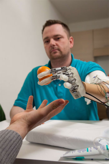 Amputado tem implantada prótese de mão que restitui o tato - AFP PHOTO 