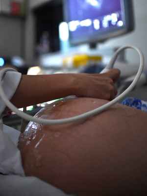 Bebês de mães com zika serão acompanhados, diz ministro da saúde - Fotos Públicas 