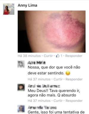 Jovem diz ter se machucado em tirolesa no Bairro Mangabeiras; empresa nega - Reprodução/Facebook