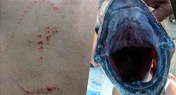 Turista de BH é atacado por atum em Fernando de Noronha -  Léo Veras/Reprodução