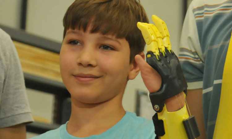 Garoto de 11 anos ganha prótese criada com impressora 3D em Belo Horizonte