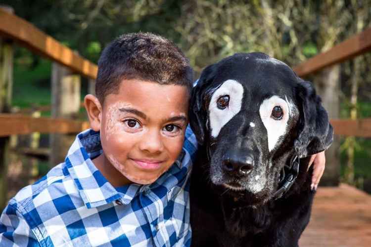 Menino com vitiligo se torna amigo de cachorro com a mesma condição - Reprodução/Facebook/Stephanie Lynn Adcock
