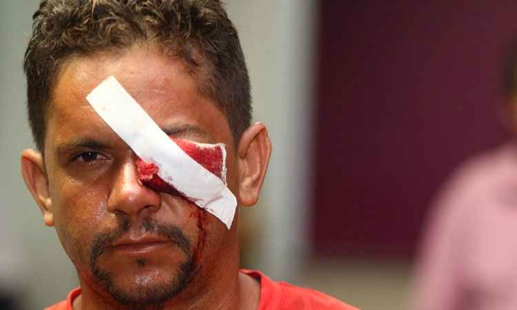 Homem atingido durante protesto pode perder a visão do olho esquerdo - Luiz Nova/Esp. CB/D.A Press