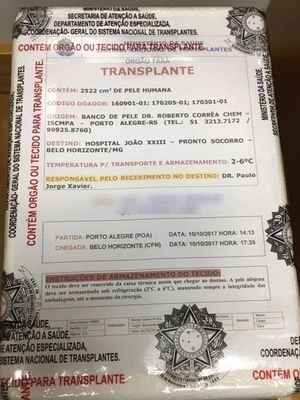 Lote de pele chega a BH para tratamento de vítima de tragédia de Janaúba - SBCP/Divulgação