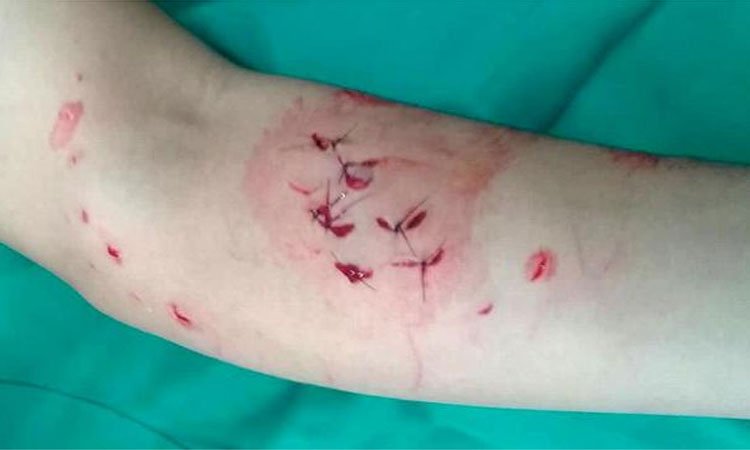 Turista é mordido por tubarão em Fernando de Noronha - Reprodução/Facebook