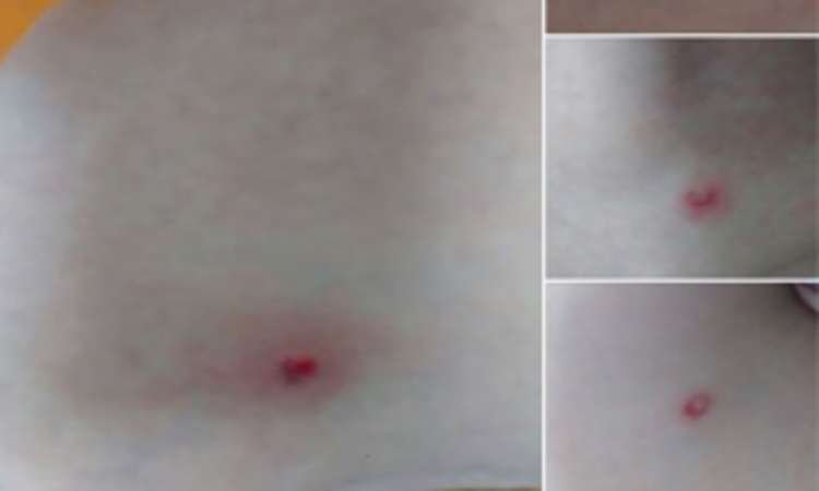 Pedestres denunciam ter sido atingidos por tiros de arma de pressão em Lourdes e no Centro - Facebook/Reprodução