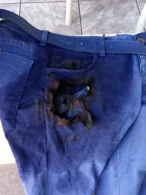 Celular explode em bolso de calça e fere usuário em Araçatuba, no interior de SP - Reprodução/Twitter 