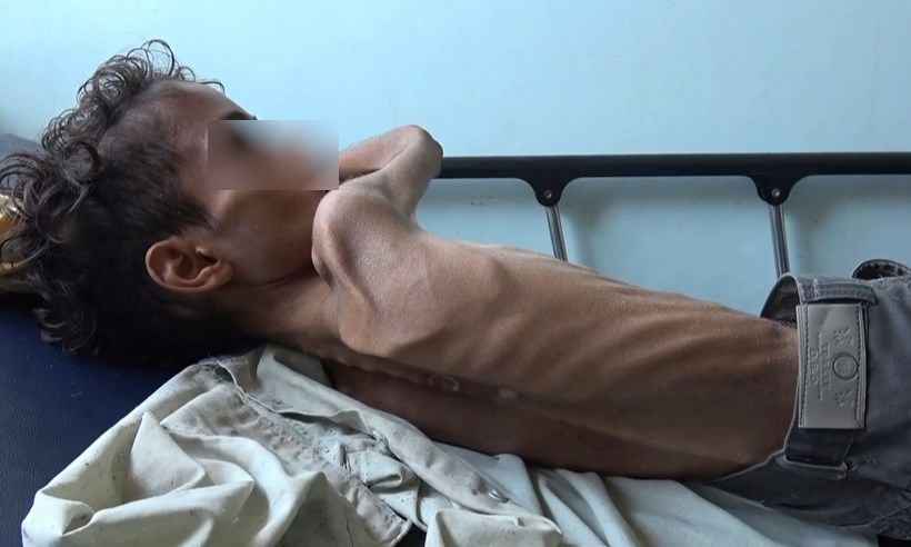 Fome e doenças matam 85.000 crianças no Iêmen - marzooq AL-JABIRY / AFP