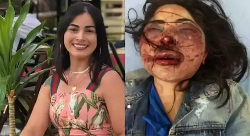 Mulher agredida e abandonada em estrada recebe alta do hospital  - Divulgação/Rede Social e Polícia Militar