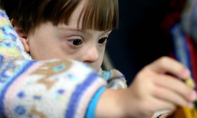 Mutações genéticas e a criança com deficiência intelectual - Roberto Ortega - CC 