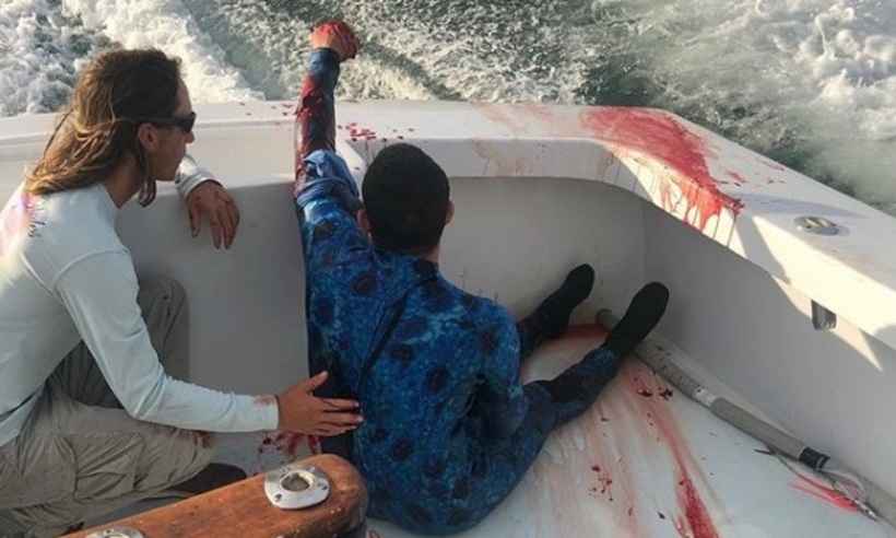 Pescador é salvo após ter o braço mordido por tubarão em Miami, nos EUA; veja vídeo - Reprodução/hot_shot_charters/Instagram