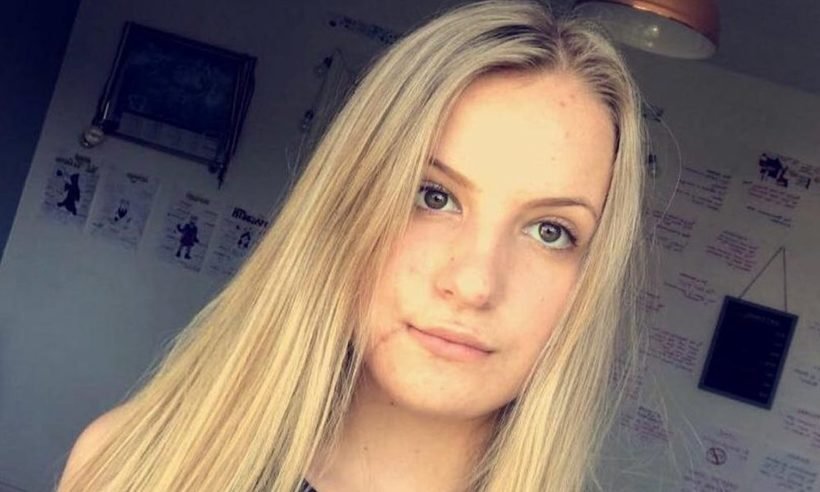 Cirurgia reconstrói rosto de adolescente que quebrou mandíbula - Reprodução/Instagarm
