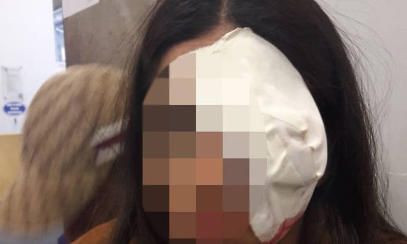 Adolescente é atingida por bala de borracha e fica cega  - Reprodução/Facebook