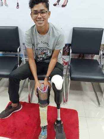 Jovem que fez perna mecânica com sucata de bicicleta ganha prótese - Conforpés/Divulgação