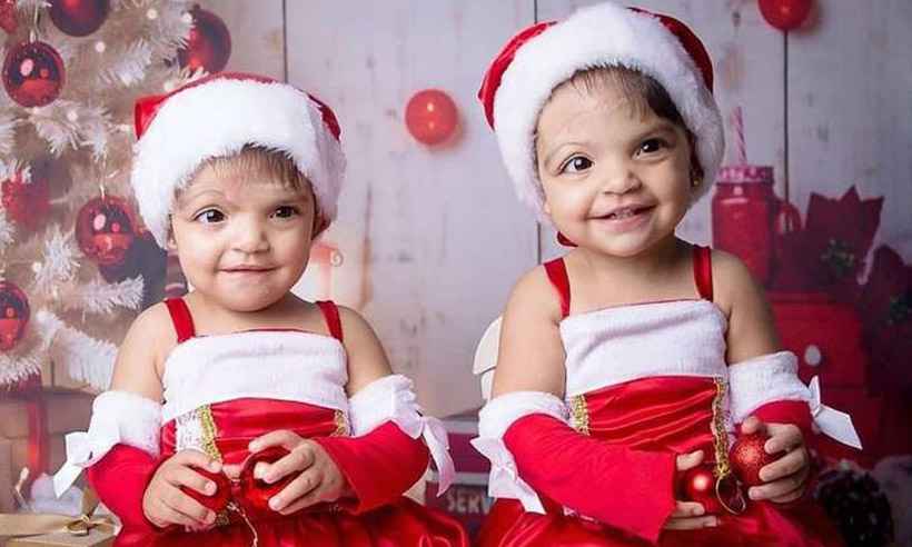 Gêmeas siamesas celebram o primeiro Natal após a cirurgia de separação - Nayara Stival/Divulgação