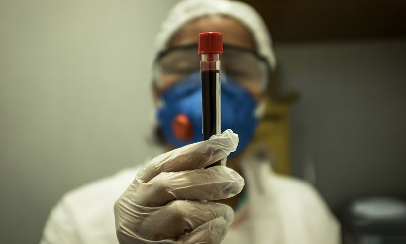 Coronavírus: controle de qualidade causa atraso na entrega de testes em Ipatinga - Florian Plaucheur/AFP