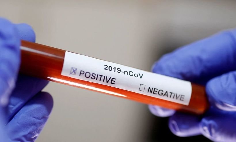 COVID-19: Anvisa publica permissão de testes rápidos em farmácias - Divulgação/ Agência Brasil