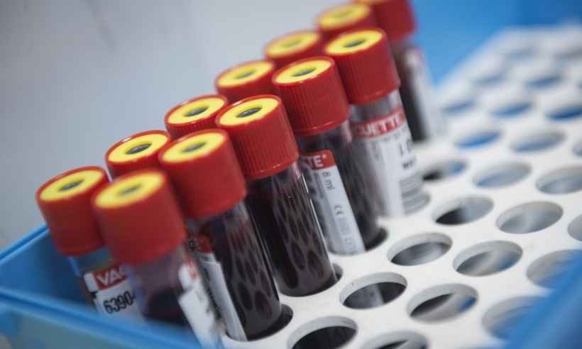 COVID-19: Teste de vacina tem primeiros resultados positivos nos Estados Unidos - MIGUEL RIOPA / AFP