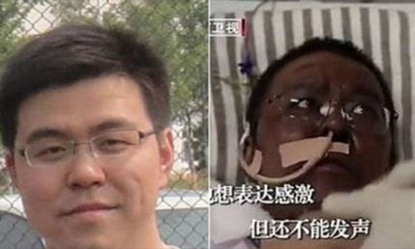 Médico de Wuhan que ficou com pele escura por causa de COVID-19 morre na China - Reprodução/ Twitter 