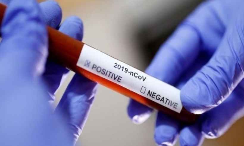Coronavírus: 19 cidades da Região Central têm pelo menos um caso confirmado - Reprodução / Internet