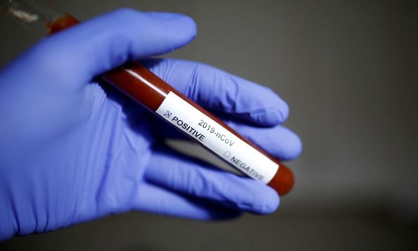 Entenda quem pode fazer teste para coronavírus pelo plano de saúde - Dado Ruvic/REUTERS