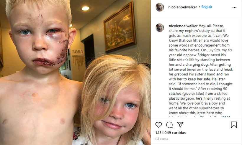 Menino de 6 anos atacado por cachorro para salvar a irmã comove famosos - Reprodução da internet/Instagram/nicolenoelwalker