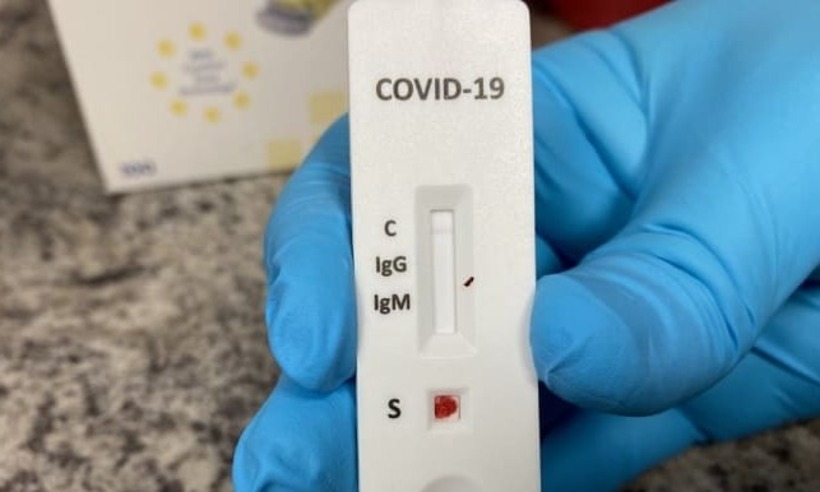 COVID-19: preços de exames variam em até 152% em BH, diz pesquisa  - Reprodução/ Internet