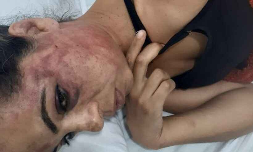 Diarista acusa PM de agressão: 'Me colocou na viatura e me levou para o quartel. Aí apanhei'  - Luiz Eduardo/Diário Independente
