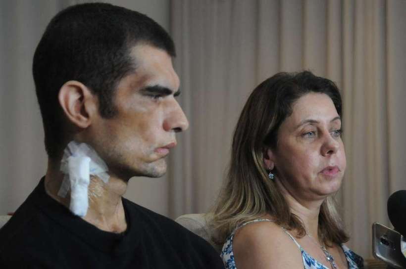 Vítima da Backer recebe rim da mulher em cirurgia bem-sucedida - Túlio Santos/EM/D.A Press - 06/03/2020