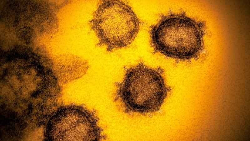 Enigma da pandemia: os genes que ajudam a entender porque algumas pessoas ficam mais doentes que outras - Science Photo Library