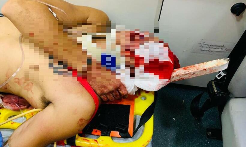 Ferro fica cravado no ombro do motociclista após colisão em Araguari - Corpo de Bombeiros / Divulgação