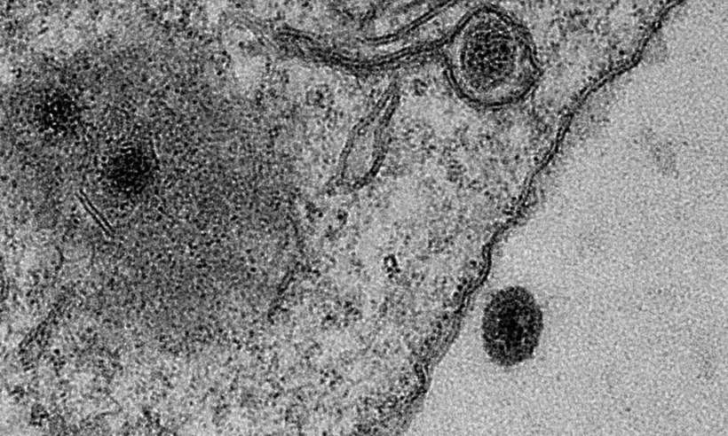 Revista cita descoberta de vírus misterioso pela UFMG como destaque em 2020 - Jônatas Abrahão e IHU-Marseille/Centro de Microscopia UFMG