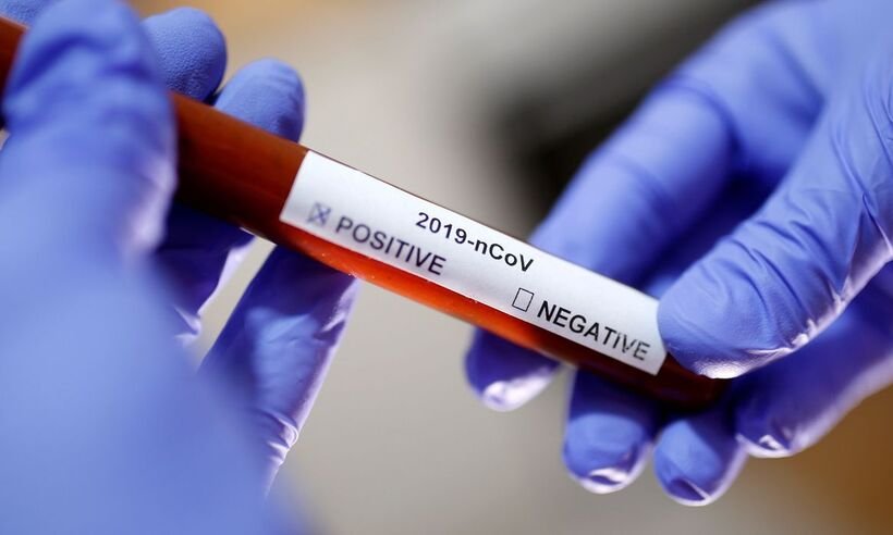 COVID-19: MG registra 119 mortes nas últimas 24h e 3.184 casos confirmados - Agência Brasil