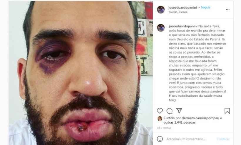 Médico infectologista é espancado após fazer alerta sobre perigos da COVID - Instagram/Reprodução