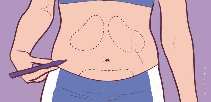 Saiba o que é lipoenxertia e quando o procedimento é indicado