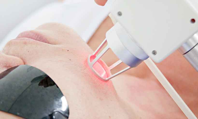 O que você pode e o que não deve fazer após um procedimento facial - Spa Premier/Divulgação