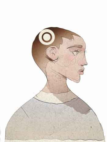 Câncer cerebral: um inimigo raro, mas impactante