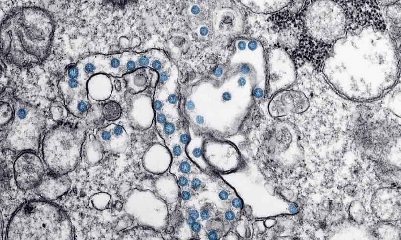Médico explica fatos e equívocos sobre a mucormicose ou 'fungo preto' - CDC/Unsplash