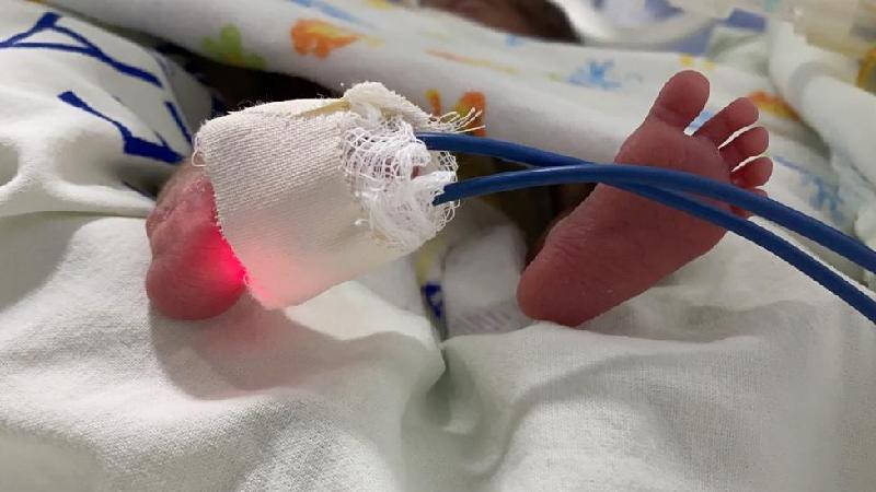 Gêmeas prematuras que perderam mãe para COVID-19 lutam pela vida em UTI - iSEA
