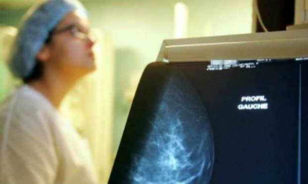 Mulheres devem esperar 4 semanas após vacina para fazer mamografia  - AFP