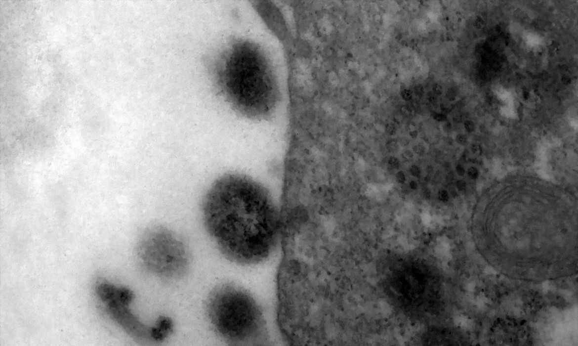 COVID-19: anticorpos podem durar até 12 meses após infecção  - Débora Barreto/Fiocruz