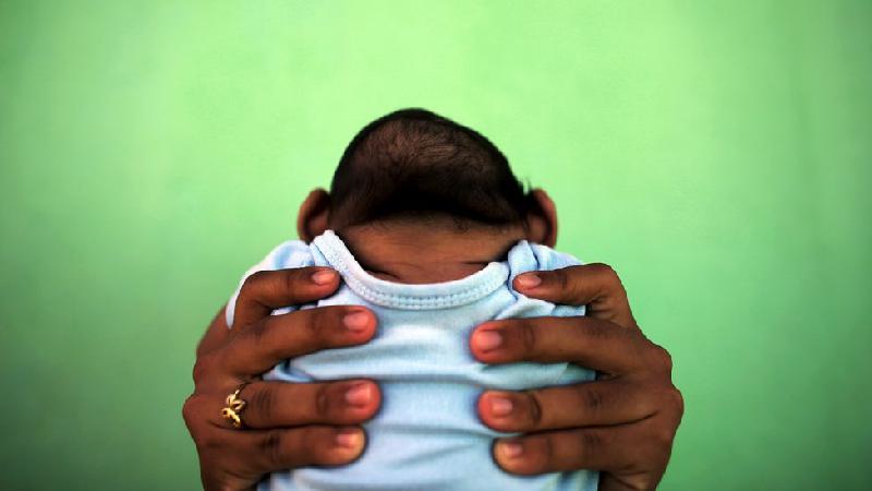 A criança com microcefalia que perdeu a mãe para a COVID-19 - REUTERS/Nacho Doce 