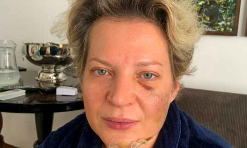 Caso Joice Hasselmann: Polícia Legislativa encaminha investigação ao MPF - Redes Sociais/Reprodução