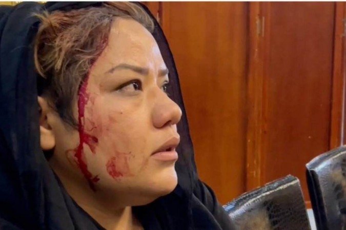 Talibã chicoteia e espanca mulheres em manifestação em Cabul - Arquivo Pessoal/CB