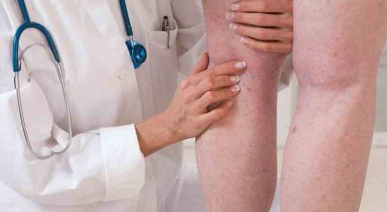 Dia Mundial da Trombose: doença mata uma a cada quatro pessoas no mundo -  ocirurgiaovascular.com.br/Reprodução
