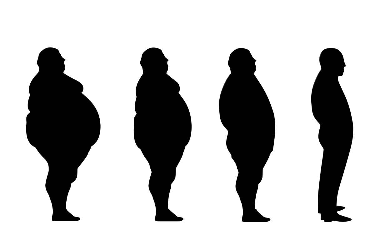 Gordofobia: alerta sobre obesidade é mais que necessário - Tumisu/Pixabay
