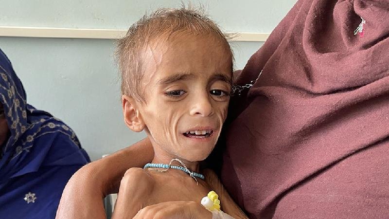 Médicos falam do desespero para salvar bebês e pacientes de 'inferno' - Getty Images