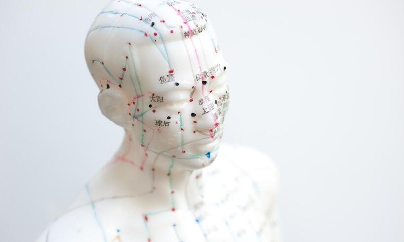 Acupuntura: aliada da saúde mental e até sequelas deixadas pela COVID-19 -  Acupuncture Box/Pixabay